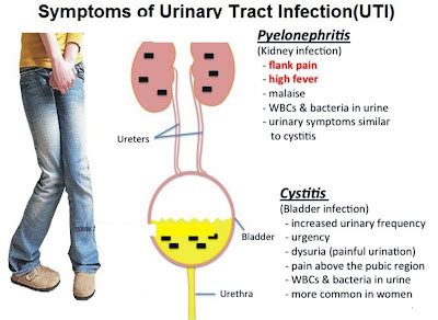 Symptoms of Urinary Tract Infection (UTI) | Medical Study Stuff