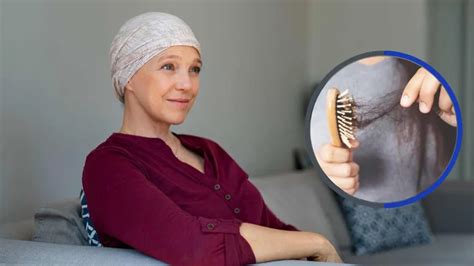 Does Cancer Cause Hair Loss? Facts to Know - After SYBIL