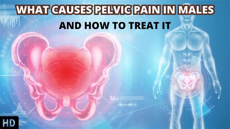 Chronic Pelvic Pain: Causes, Characteristics Treatment, 48% OFF