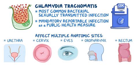 Chlamydia trachomatis infection: Clinical sciences - Osmosis Video Library