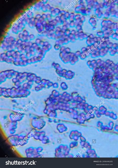 Staphylococcus Aureus Microscope