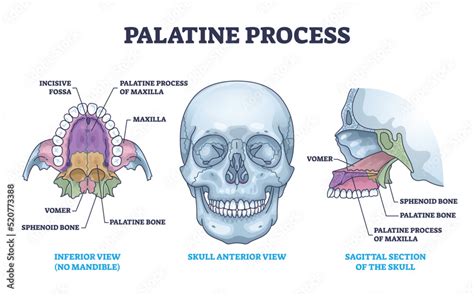 Palatine process section anatomy with maxilla structure outline diagram ...