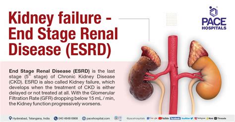 Kidney failure - End-Stage Renal Disease: Symptoms, Causes & Treatment