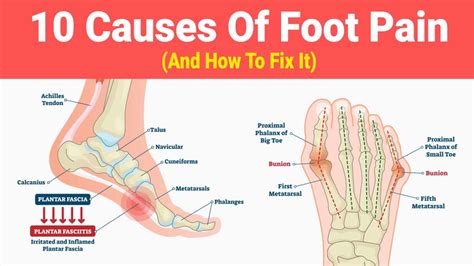 Common types of foot pain - Advance European Medicare Center