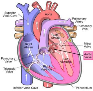 Aortic stenosis causes, symptoms, diagnosis, treatment & surgery