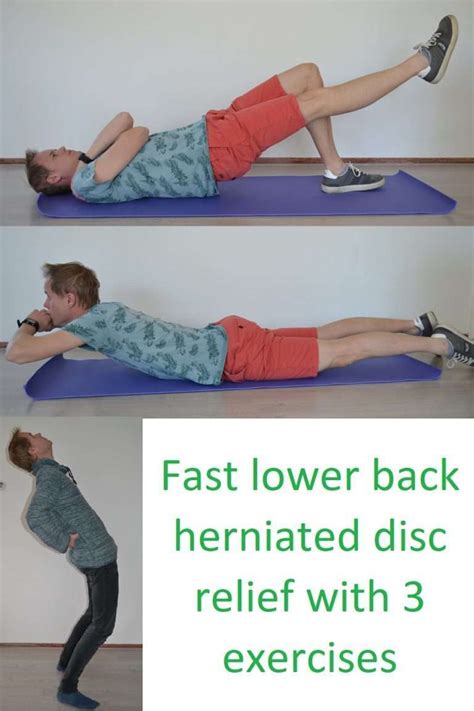 Herniated disc treatment L5-S1 with 3 exercises to avoid surgery