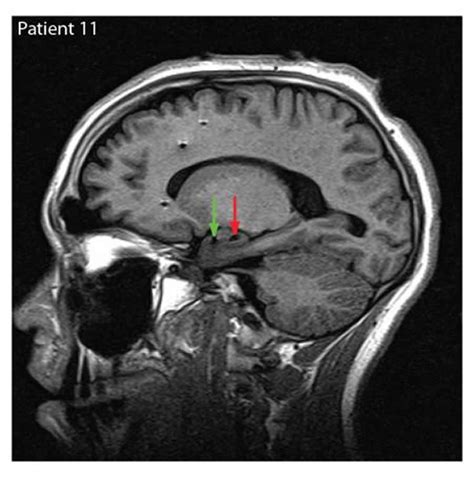 Sorting Out Emotions - Neuroscience News