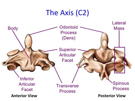 C2 Spine: Anatomy, Bony Landmark » How To Relief