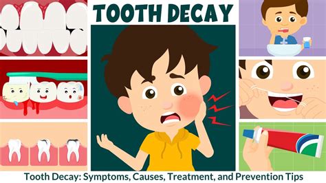 Cavities (Tooth Decay): Symptoms, Causes & Treatment - weheartanimals.info