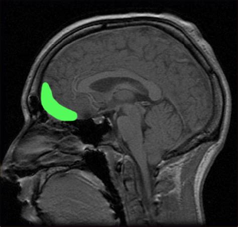 Orbitofrontal cortex | Wiki | Everipedia