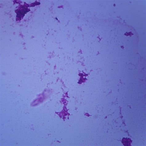 Mycobacterium tuberculosis, w.m. Microscope Slide | Carolina.com