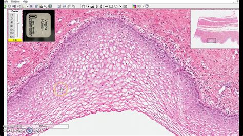 non-keratinized stratified squamous epithelium - YouTube