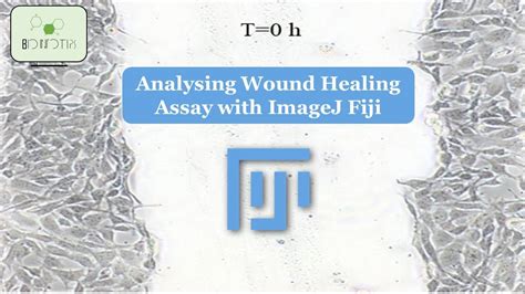 Unlock the Secrets of Wound Healing: Learn How to Analyze Scratch ...