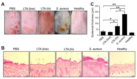 J | Free Full-Text | The Unique Immunoregulatory Function of ...