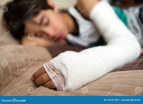 Broken hand in cast stock image. Image of plaster, hurt - 123137781