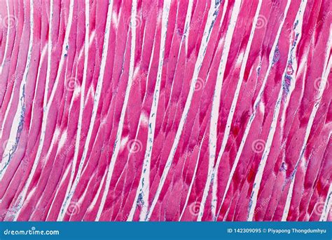 Histological Sample Striated Skeletal Muscle of Mammal Tissue Under the ...