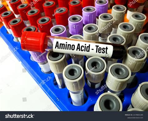 747 Amino acid test Images, Stock Photos & Vectors | Shutterstock