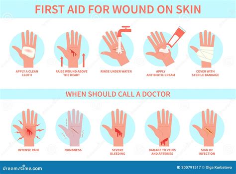 First Aid for Wound on Skin. Damage, Bleeding Cut Hand Skin and ...