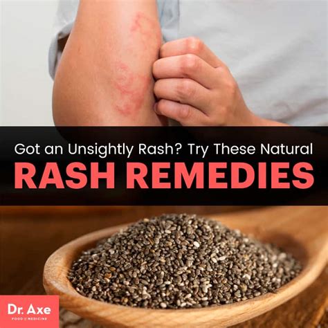 How to Get Rid of a Rash: 6 Natural Rash Remedies - DrAxe.com