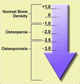 T-Scores - SHP - Tone Your Bones