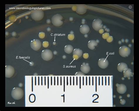 Staphylococcus Aureus Colony Morphology