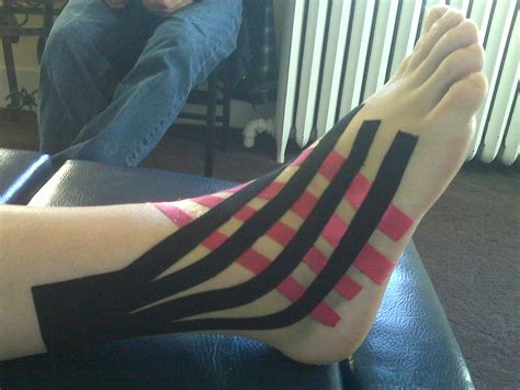 Kinesio Tape / KT for Ankle Sprains – Denver Chiropractic, LLC