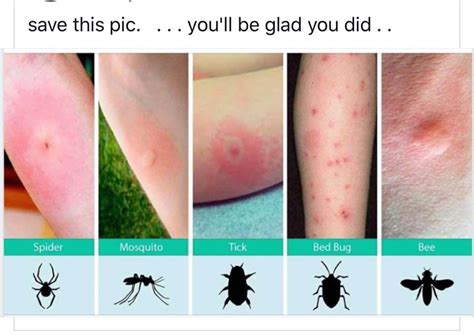 How to identify insect bites🐜🦗 Follow us for more hacks😎 #insectbites # ...