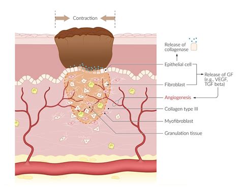 Granulation Tissue Wound Healing Stages