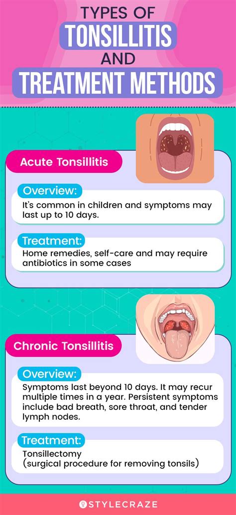 23 Home Remedies For Tonsils | Causes And Prevention Tips