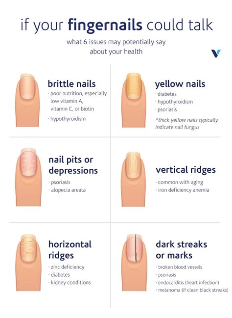 What Your Fingernails Say About Your Health | What's Good by V