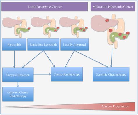 Treatment options for pancreatic cancer: Treatment plans are ...