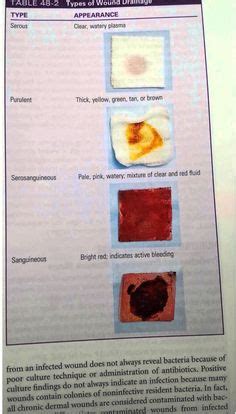 Image result for sanguineous vs serosanguineous | Fundamentals-Nursing ...