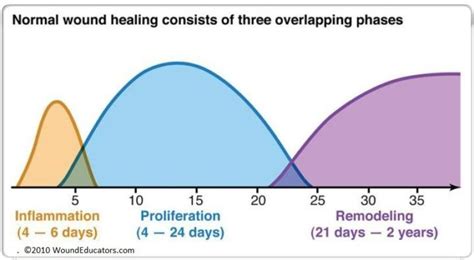 Surgical Wound Healing Stages