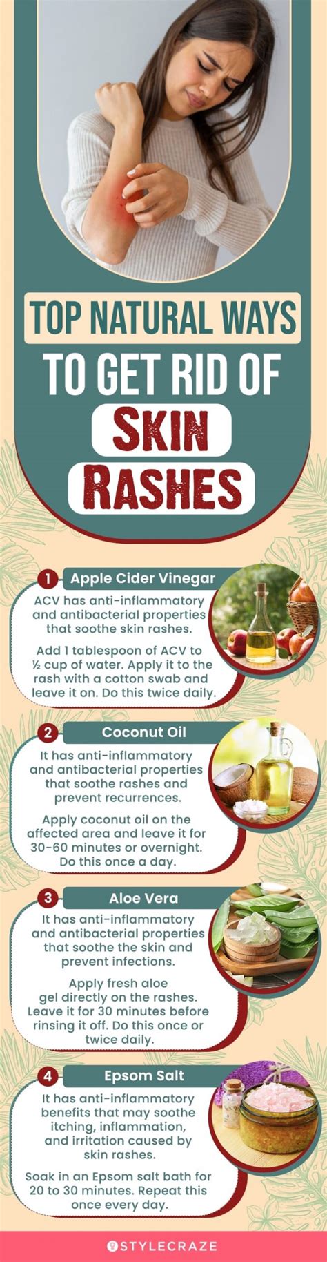 What Stops Hives From Itching Fast