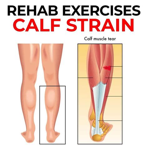 🚨 3 CALF STRAIN REHAB EXERCISES 🚨 The calf muscle consist of the ...