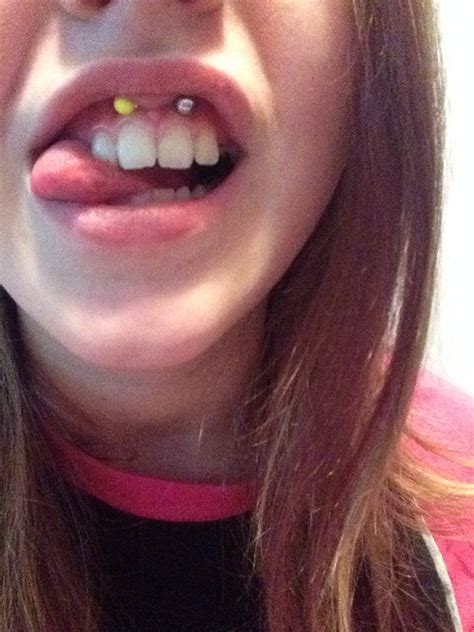 Infected Smiley Piercing Pictures | Best Piercing Ideas