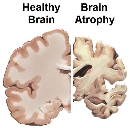 How Music Can Boost Cognitive Function In Older Adults