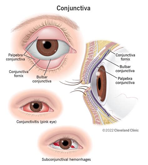 Conjunctiva: Anatomy, Function & Common Conditions