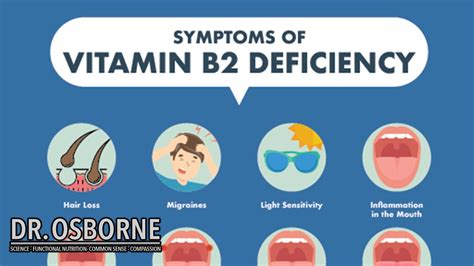 Symptoms of Vitamin B2 Deficiency - YouTube