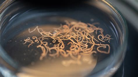 What Do Roundworms Look Like In Human Stool - Infoupdate.org