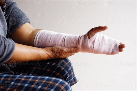 Closeup hand wrapped with bandage on sprain wrist, injury arm treatment ...