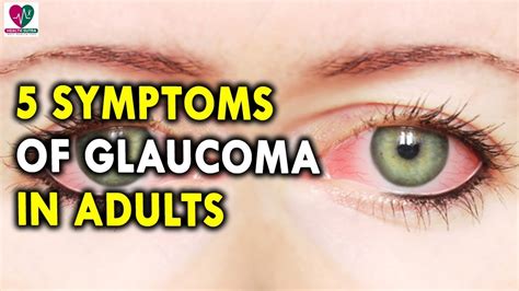 Symptoms Of Glaucoma In Adults - Best Health Tips for Eyes - YouTube