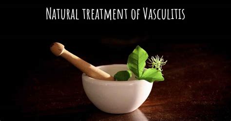 Is there any natural treatment for Vasculitis?