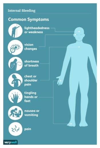 Personal Injury Claims Involving Internal Bleeding | Samples Ames, PLLC