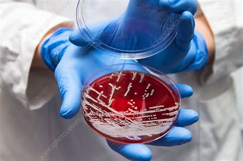 Staphylococcus aureus culture - Stock Image - C035/7525 - Science Photo ...