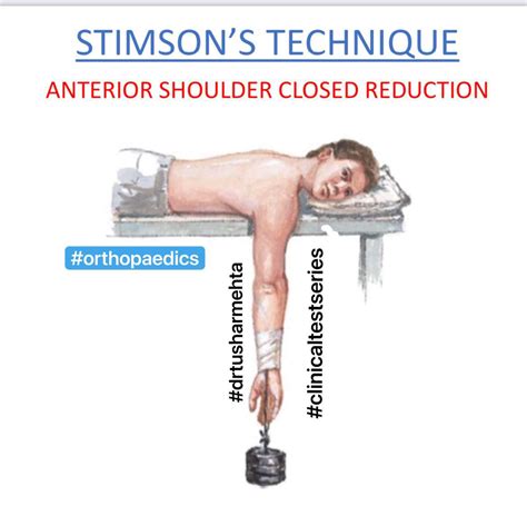 The four methods of reduction of... - Orthopaedics Plus | Facebook