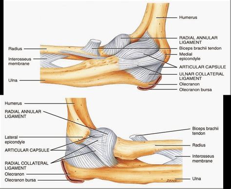 Golfer's Elbow