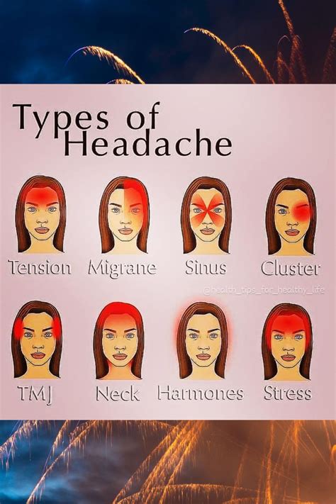 Headache types – Artofit