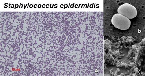 Staphylococcus epidermidis- An Overview - Microbe Notes