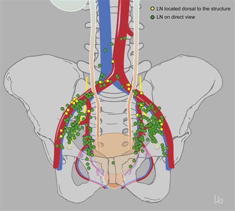 A New Multimodality Technique Accurately Maps the Primary Lymphatic ...